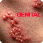 Genital Herpes icon