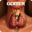 Goiter Disease icono