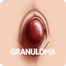 Granuloma Disease APK