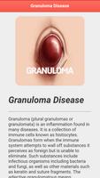 Granuloma Disease capture d'écran 3