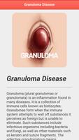 Granuloma Disease 截圖 3
