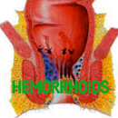 Hemorrhoids Disease APK