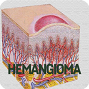 Hemangioma Disease APK