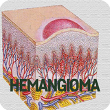 Hemangioma Disease icon