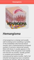 Hemangioma Disease capture d'écran 2