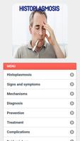 Histoplasmosis Disease ảnh chụp màn hình 2