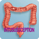 Intussusception Disease APK