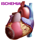 Ischemia Disease 아이콘