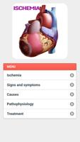 Ischemia Disease 스크린샷 2