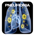 Pneumonia Disease