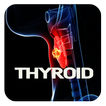 Thyroid Cancer