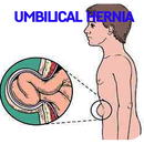 Umbilical Hernia Disease APK