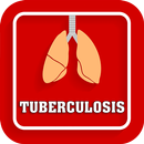 APK Tuberculosis