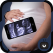 ”Scanner Pregnant Xray Prank