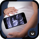 Icona Scanner Pregnant Xray Prank
