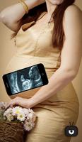 Scanner Pregnant Xray Prank capture d'écran 2