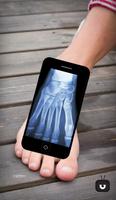 Xray Scanner Foot Simulated 截图 1