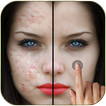 Pimple Remover Photo Editor