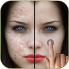 Pimple Remover Photo Editor иконка