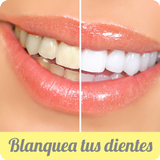 Como blanquear los dientes icône