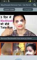 Blackheads Removal Tips - Get Rid of Black Heads ภาพหน้าจอ 1