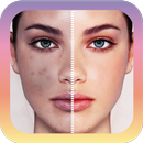 Cactus Photo Blemish editor APK