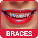 Beauty Braces Editor APK