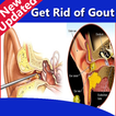 Get Rid of Gout