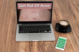 How To Get Rid of Acne Fast الملصق