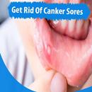 How To Get Rid Of Canker Sores (Causes+Remedies) aplikacja