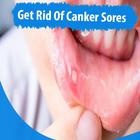 How To Get Rid Of Canker Sores ikona