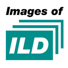 Images of ILD-icoon