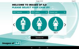 Images of ILD-poster