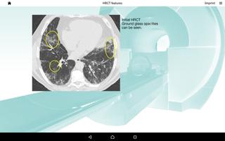 Images of ILD ภาพหน้าจอ 2