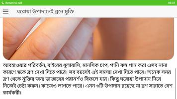 ব্রণ থেকে মুক্তি পেতে screenshot 3