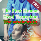 The First Human Head Transplant icône