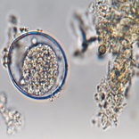 ATLAS DE COPROLOGÍA AR