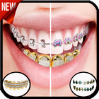 Gold Teeth & Braces photo editor icono