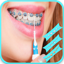 braces bretelles teeth both pro APK