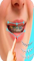 braces bretelles teeth both pro স্ক্রিনশট 3