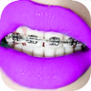 Braces on Photo Editor - Real Braces Teeth Pro APK