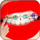 Braces Photo Editor 圖標