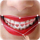 الأقواس اسنان - Braces أيقونة