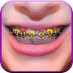 Braces Beauty Photo Editor