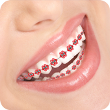 Braces Photo ikona