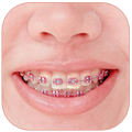 ”Braces Photo Editor