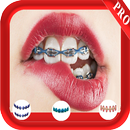 Braces Photo Booth APK