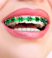 Braces Beauty Photo Editor screenshot 2