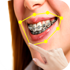 braces colored teeth real أيقونة