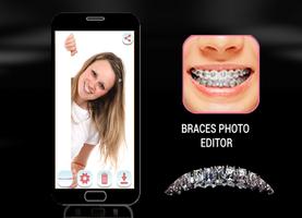 Braces Bretelles teeth both 2018 اسکرین شاٹ 1